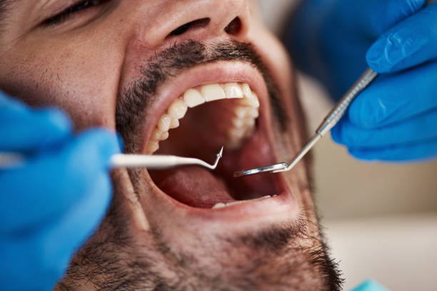 Best Emergency Dentist for Knocked-Out Tooth in Colstrip, MT
